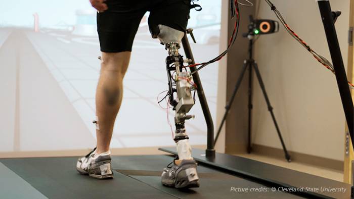 Issues with Traditional Powered Prostheses